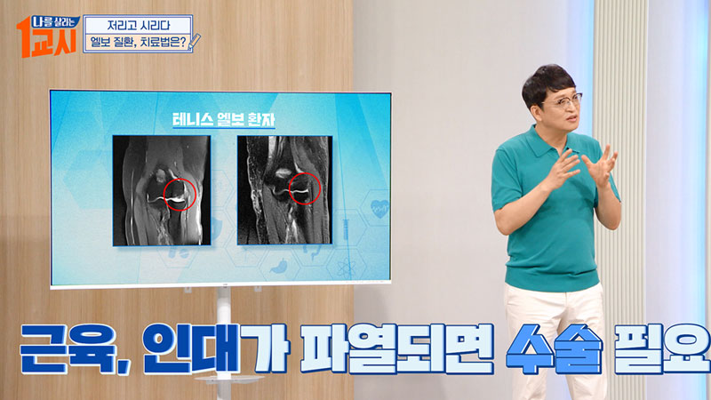 MBC 나를 살리는 1교시 방송 출연
