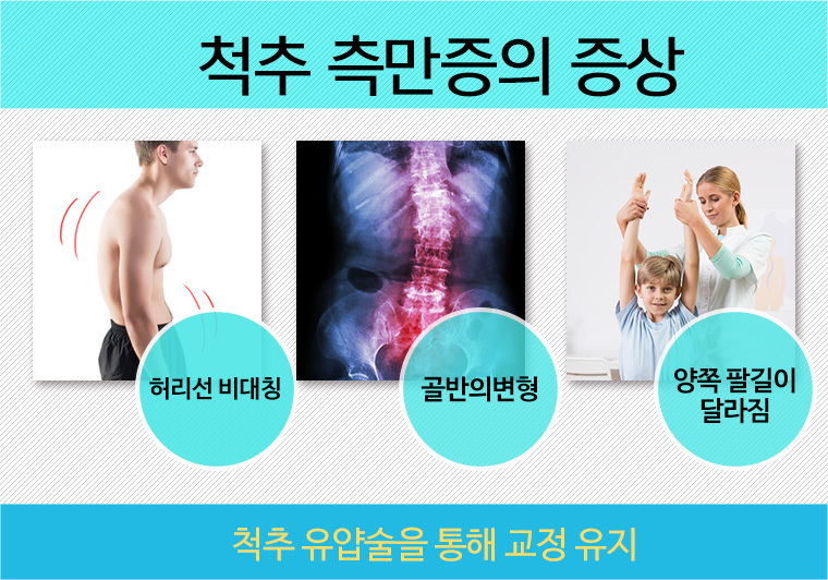 여드름관리