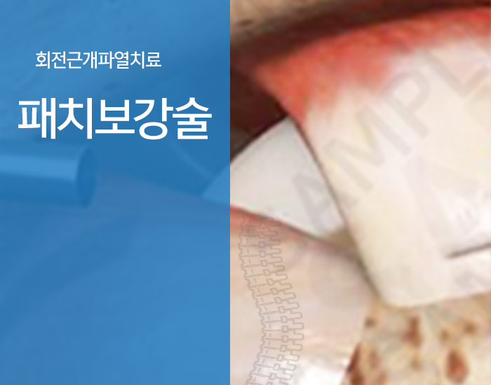이미지명