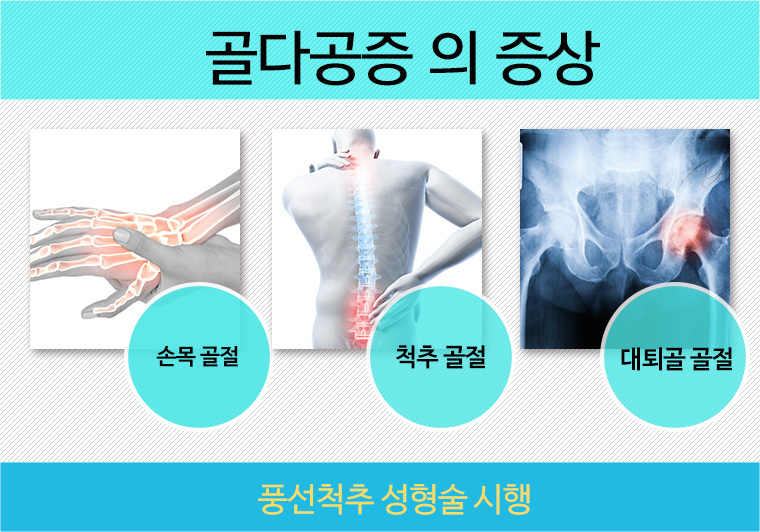 여드름관리
