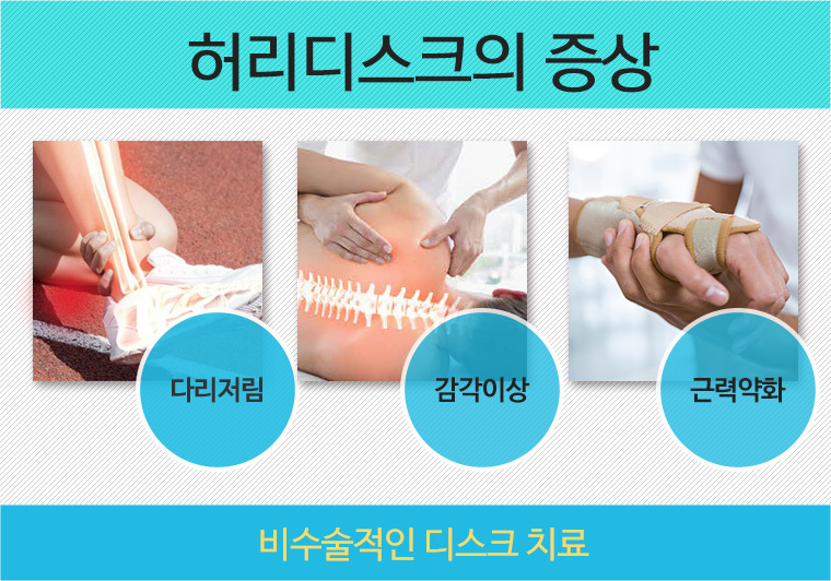 여드름관리