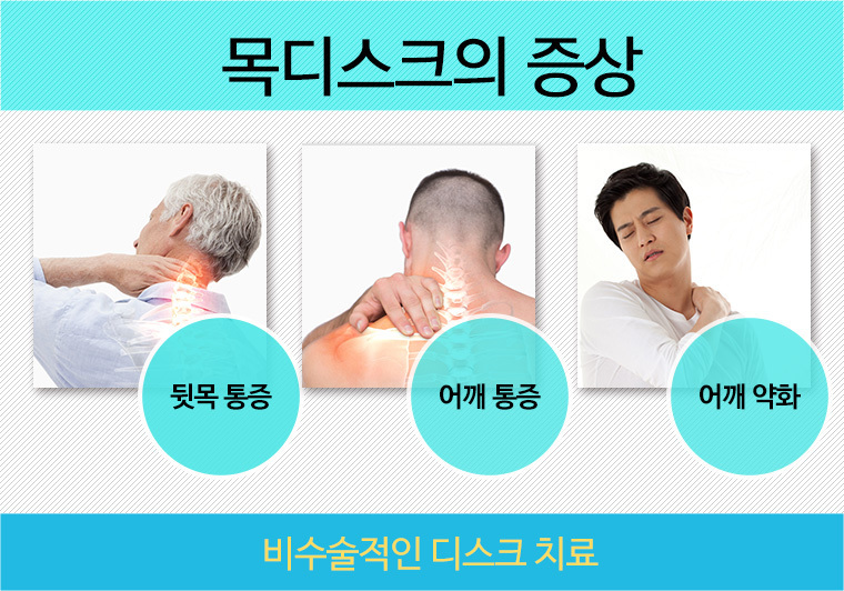 여드름관리