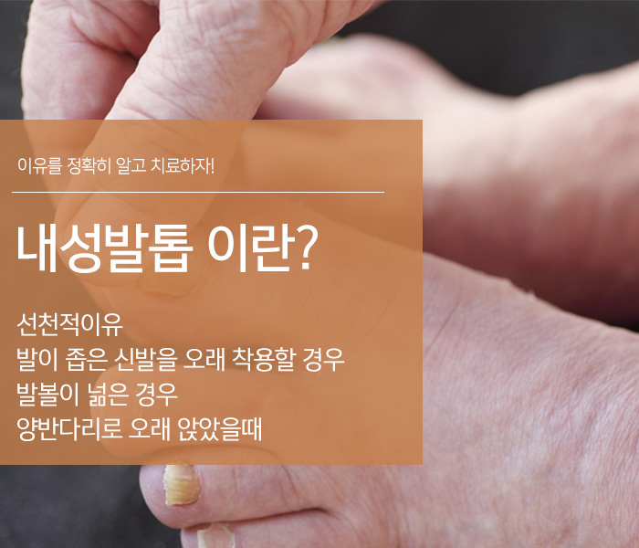 여드름관리