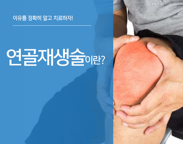 이미지명