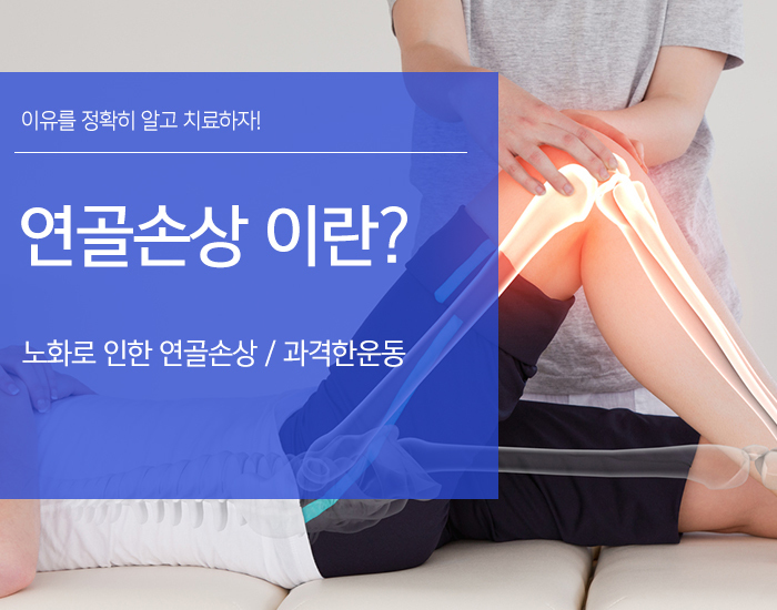 이미지명