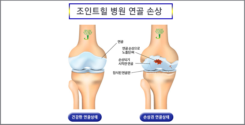 이미지명
