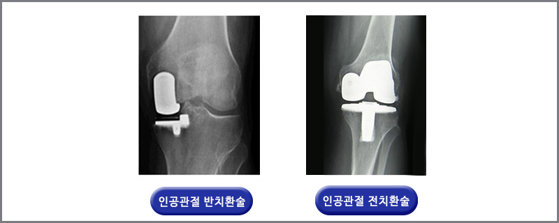 이미지명