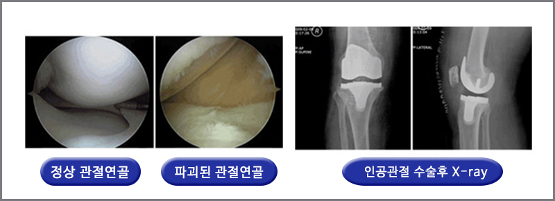 이미지명