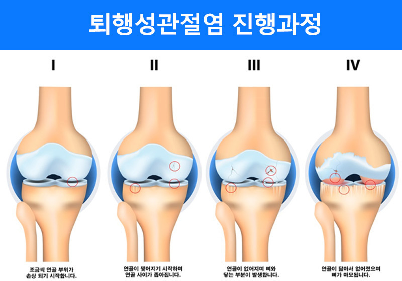 이미지명