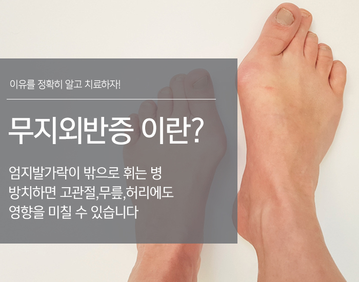 여드름관리