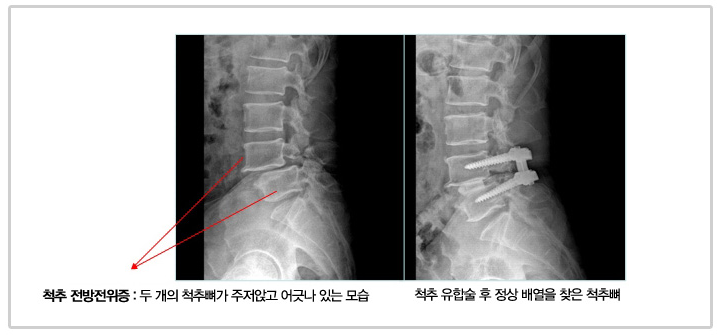 이미지명