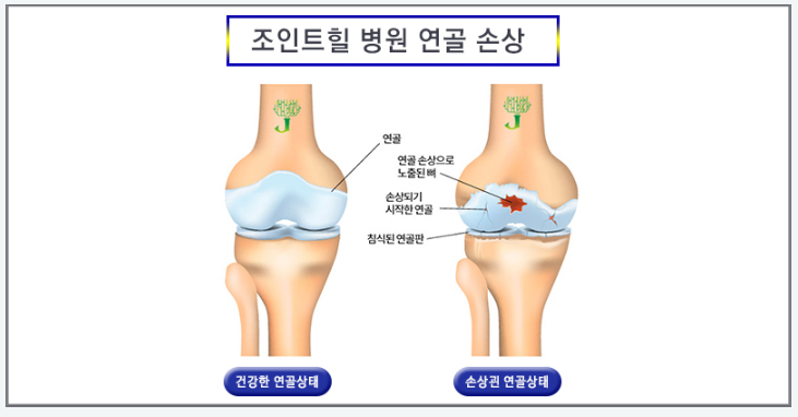 이미지명