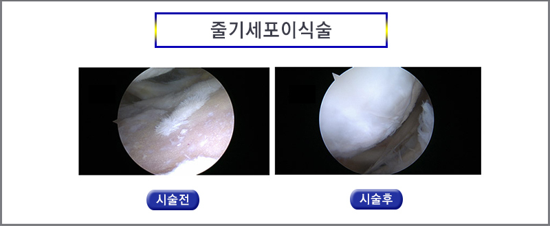 이미지명
